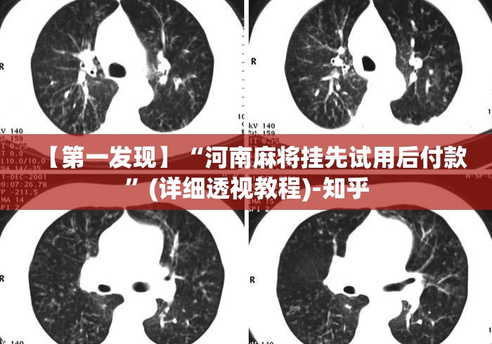 【第一发现】“河南麻将挂先试用后付款”(详细透视教程)-知乎