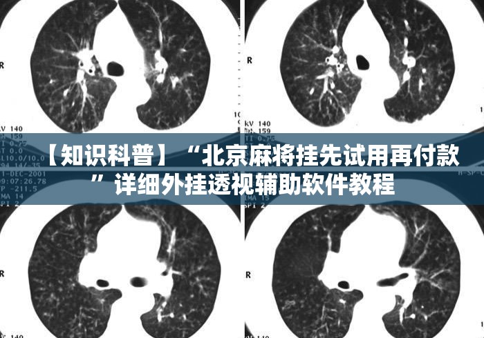 【知识科普】“北京麻将挂先试用再付款”详细外挂透视辅助软件教程